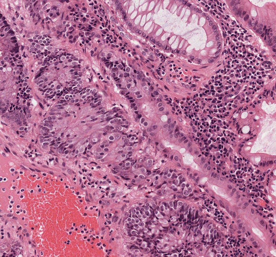 Octo Immune: raw slide