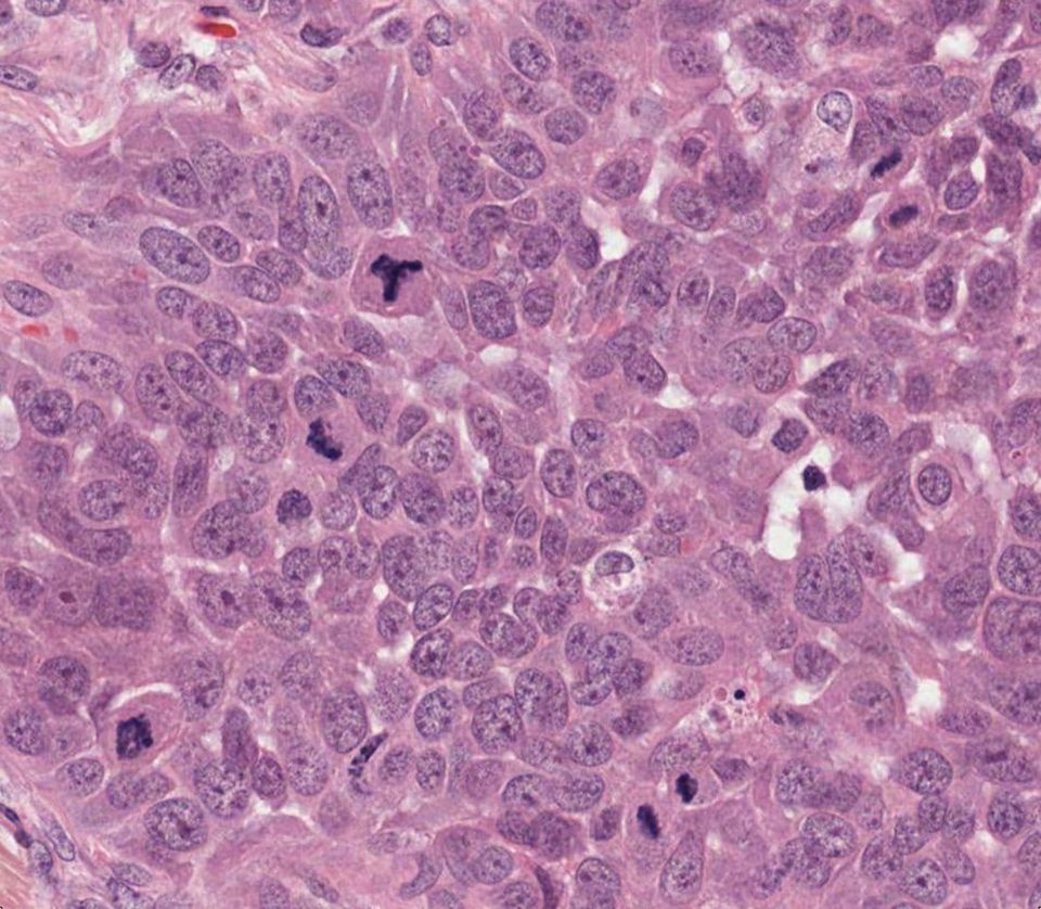 Octo Mitosis: raw slide