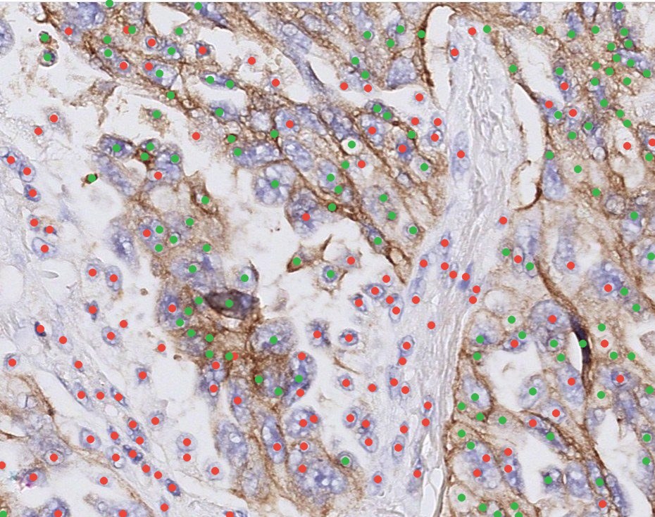 PD-L1 IHC with every cell called positive or negative by Nemo