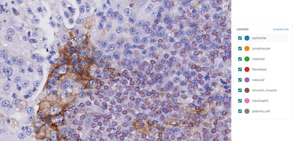 Nemo PD-L1: positive tumour cells, TPS / CPS readout
