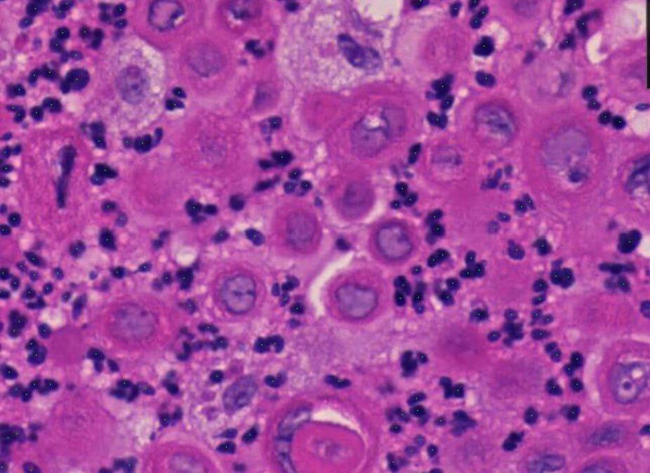Granulocytes detected by Kraken on H&amp;E